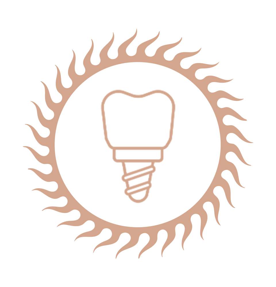 single dental implant sun frame