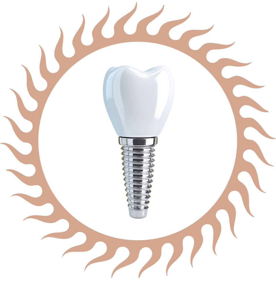 Traditional Dental Implant