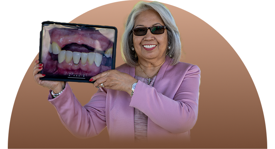 Patient Holding up before and after image