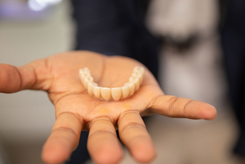 full arch dental implants